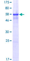 CD300A Protein - 12.5% SDS-PAGE of human CD300A stained with Coomassie Blue