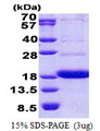 CD300A Protein