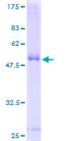 CD300C Protein - 12.5% SDS-PAGE of human CD300C stained with Coomassie Blue