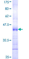 CD300C Protein - 12.5% SDS-PAGE Stained with Coomassie Blue.