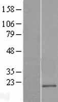 CD300E Protein - Western validation with an anti-DDK antibody * L: Control HEK293 lysate R: Over-expression lysate