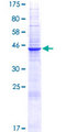 CD300E Protein - 12.5% SDS-PAGE of human CD300E stained with Coomassie Blue