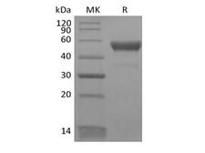 CD300LB Protein - Recombinant Human CD300LB/LMIR5 (C-Fc)