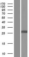 CD302 Protein - Western validation with an anti-DDK antibody * L: Control HEK293 lysate R: Over-expression lysate
