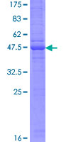 CD302 Protein - 12.5% SDS-PAGE of human CD302 stained with Coomassie Blue