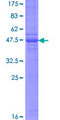 CD302 Protein - 12.5% SDS-PAGE of human CD302 stained with Coomassie Blue