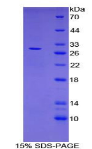 CD302 Protein - Recombinant C-Type Lectin Domain Family 13, Member A By SDS-PAGE
