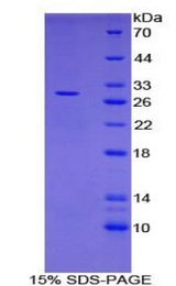CD302 Protein - Recombinant C-Type Lectin Domain Family 13, Member A By SDS-PAGE