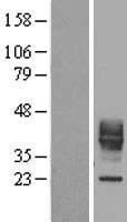 CD30L / CD153 Protein - Western validation with an anti-DDK antibody * L: Control HEK293 lysate R: Over-expression lysate