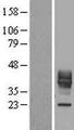 CD30L / CD153 Protein - Western validation with an anti-DDK antibody * L: Control HEK293 lysate R: Over-expression lysate