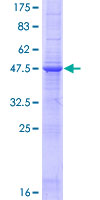 CD30L / CD153 Protein - 12.5% SDS-PAGE of human TNFSF8 stained with Coomassie Blue