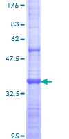CD30L / CD153 Protein - 12.5% SDS-PAGE Stained with Coomassie Blue.