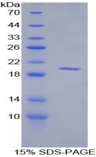 CD30L / CD153 Protein - Recombinant Cluster Of Differentiation 30 Ligand By SDS-PAGE