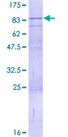 CD316 / IGSF8 Protein - 12.5% SDS-PAGE of human IGSF8 stained with Coomassie Blue
