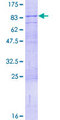CD316 / IGSF8 Protein - 12.5% SDS-PAGE of human IGSF8 stained with Coomassie Blue