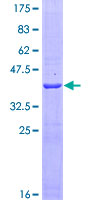 CD316 / IGSF8 Protein - 12.5% SDS-PAGE Stained with Coomassie Blue