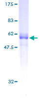 CD320 Protein - 12.5% SDS-PAGE of human CD320 stained with Coomassie Blue