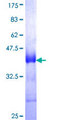 CD320 Protein - 12.5% SDS-PAGE Stained with Coomassie Blue.