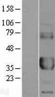 CD32A Protein - Western validation with an anti-DDK antibody * L: Control HEK293 lysate R: Over-expression lysate