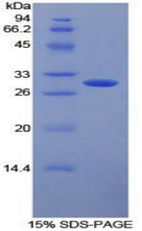 CD32A Protein - Recombinant Receptor II For The Fc Region Of Immunoglobulin G By SDS-PAGE