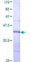 CD32B Protein - 12.5% SDS-PAGE Stained with Coomassie Blue.