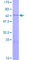 CD33 Protein - 12.5% SDS-PAGE of human CD33 stained with Coomassie Blue