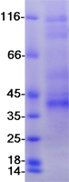 CD33 Protein - Purified recombinant protein CD33 was analyzed by SDS-PAGE gel and Coomassie Blue Staining