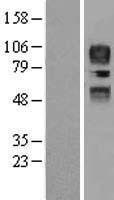 CD34 Protein - Western validation with an anti-DDK antibody * L: Control HEK293 lysate R: Over-expression lysate