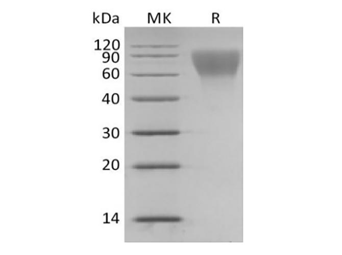 CD34 Protein - Recombinant Human Hematopoietic progenitor cell antigen CD34/CD34 (C-6His)