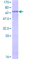 CD34 Protein - 12.5% SDS-PAGE of human CD34 stained with Coomassie Blue