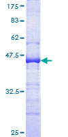 CD34 Protein - 12.5% SDS-PAGE Stained with Coomassie Blue.