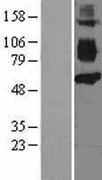 CD36 Protein - Western validation with an anti-DDK antibody * L: Control HEK293 lysate R: Over-expression lysate