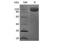 CD36 Protein - Recombinant Human platelet membrane glycoprotein IV/CD36/SR-B3 Fc Chimera Protein(Fc Tag)
