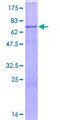 CD36 Protein - 12.5% SDS-PAGE of human CD36 stained with Coomassie Blue