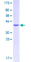 CD36 Protein - 12.5% SDS-PAGE Stained with Coomassie Blue.