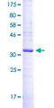 CD37 Protein - 12.5% SDS-PAGE Stained with Coomassie Blue.