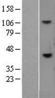CD38 Protein - Western validation with an anti-DDK antibody * L: Control HEK293 lysate R: Over-expression lysate