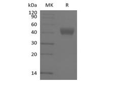 CD38 Protein - Recombinant Human ADP-ribosyl Cyclase/cyclic ADP-ribose Hydrolase 1/CD38 (N-6His-Avi) Biotinylated