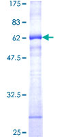 CD38 Protein - 12.5% SDS-PAGE of human CD38 stained with Coomassie Blue