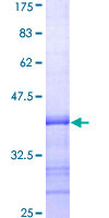 CD38 Protein - 12.5% SDS-PAGE Stained with Coomassie Blue.