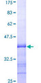 CD38 Protein - 12.5% SDS-PAGE Stained with Coomassie Blue.