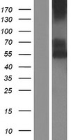 CD39 Protein - Western validation with an anti-DDK antibody * L: Control HEK293 lysate R: Over-expression lysate