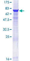 CD39 Protein - 12.5% SDS-PAGE of human ENTPD1 stained with Coomassie Blue