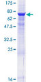 CD39 Protein - 12.5% SDS-PAGE of human ENTPD1 stained with Coomassie Blue