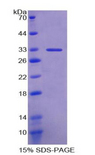 CD39 Protein - Recombinant Ectonucleoside Triphosphate Diphosphohydrolase 1 By SDS-PAGE