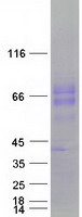 CD39 Protein - Purified recombinant protein ENTPD1 was analyzed by SDS-PAGE gel and Coomassie Blue Staining
