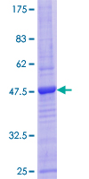 CD3D Protein - 12.5% SDS-PAGE of human CD3D stained with Coomassie Blue