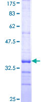 CD3D Protein - 12.5% SDS-PAGE Stained with Coomassie Blue.