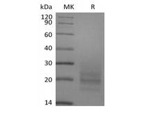 CD3E + CD3D Protein - Recombinant Human CD3D&CD3E Heterodimer (C-6His)