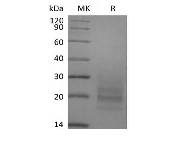 CD3E + CD3D Protein - Recombinant Human CD3D&CD3E Heterodimer (C-6His)